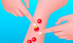 Pimple Poper Rush image